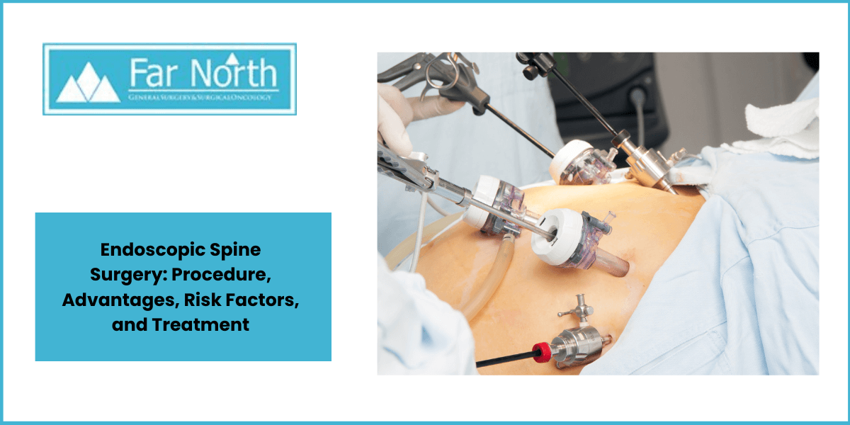 Endoscopic Spine Surgery: Procedure, Advantages, Risk Factors, and Treatment