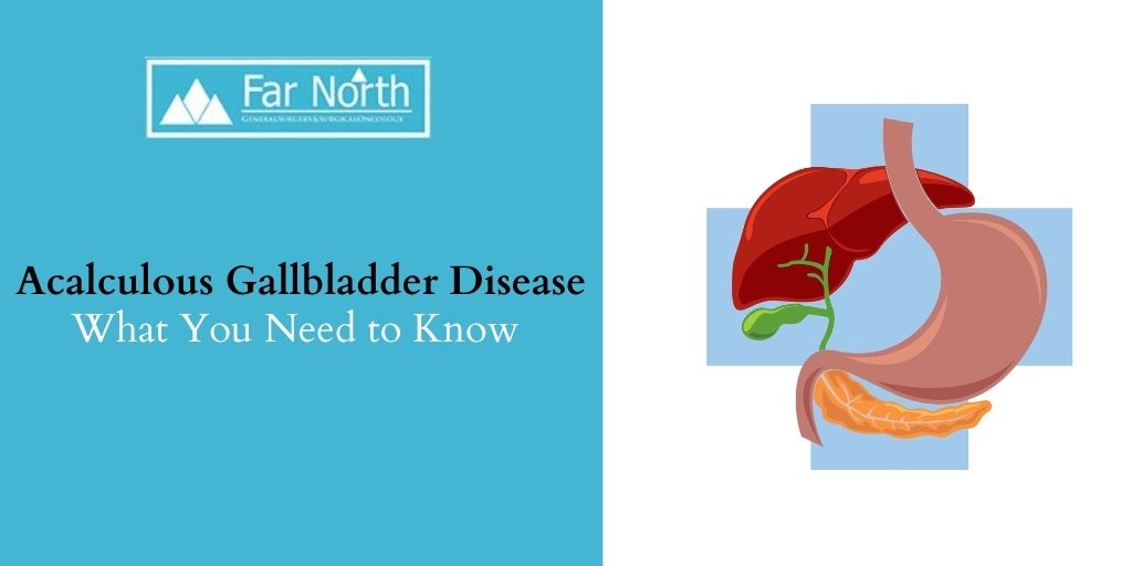Acalculous Gallbladder Disease: What You Need to Know 