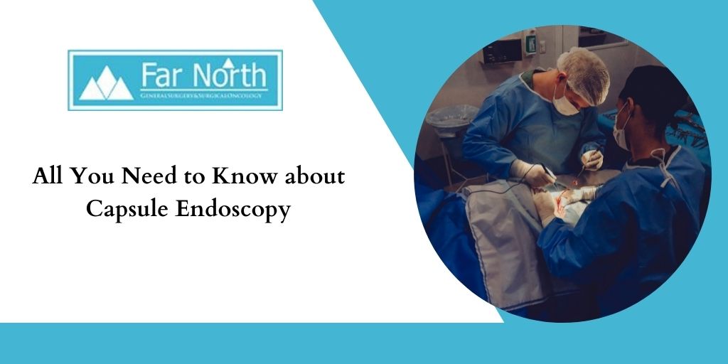 All You Need to Know about Capsule Endoscopy