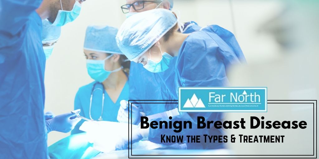 Benign Breast Disease: Know the Types & Treatment