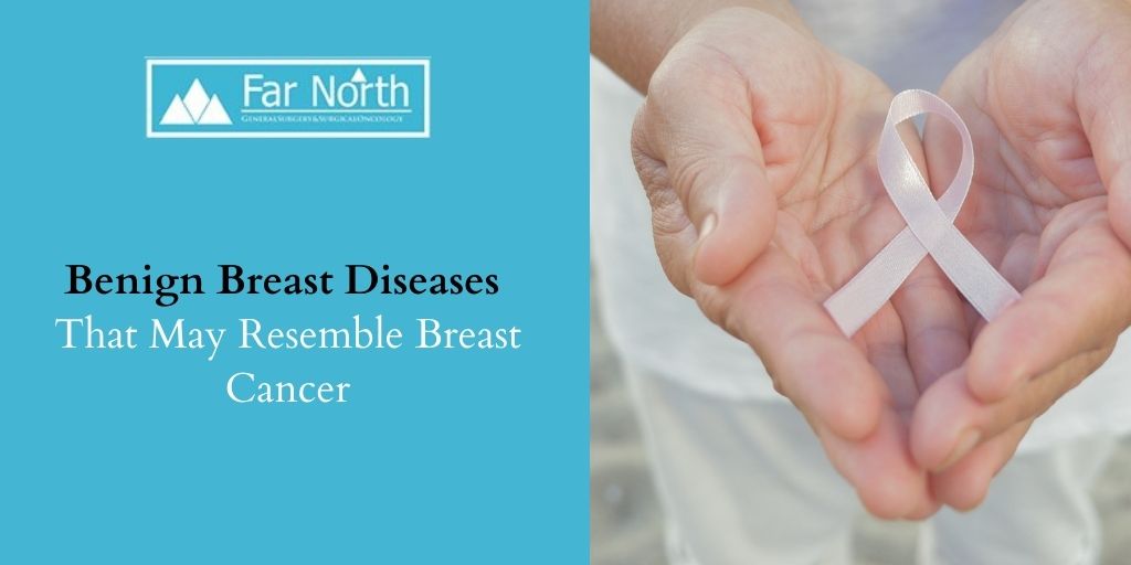 Benign Breast Diseases That May Resemble Breast Cancer