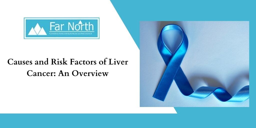 Causes and Risk Factors of Liver Cancer: An Overview