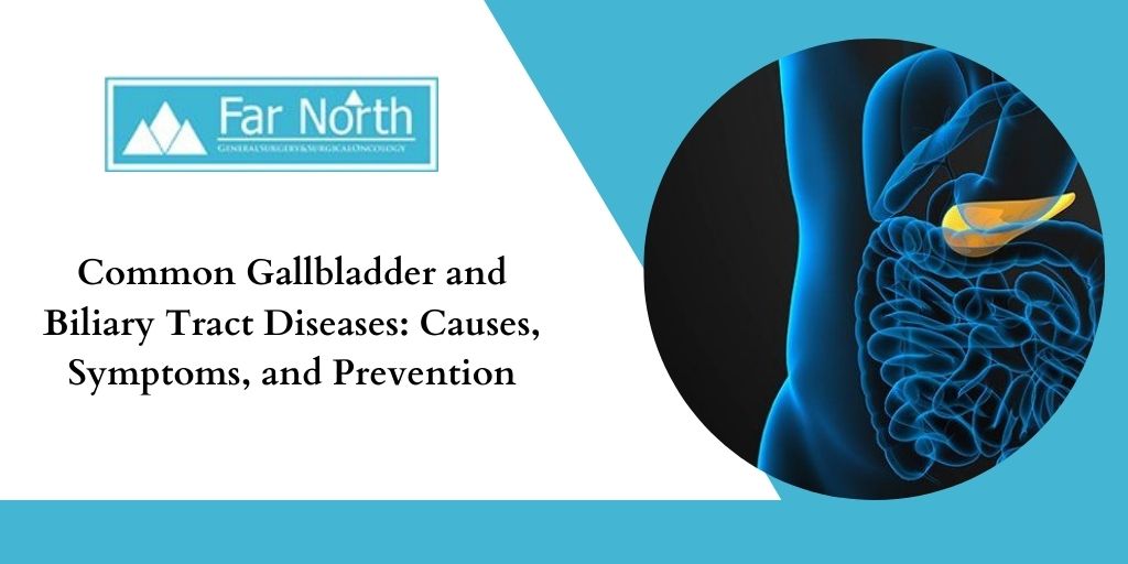 Common Gallbladder and Biliary Tract Diseases: Causes, Symptoms, and ...