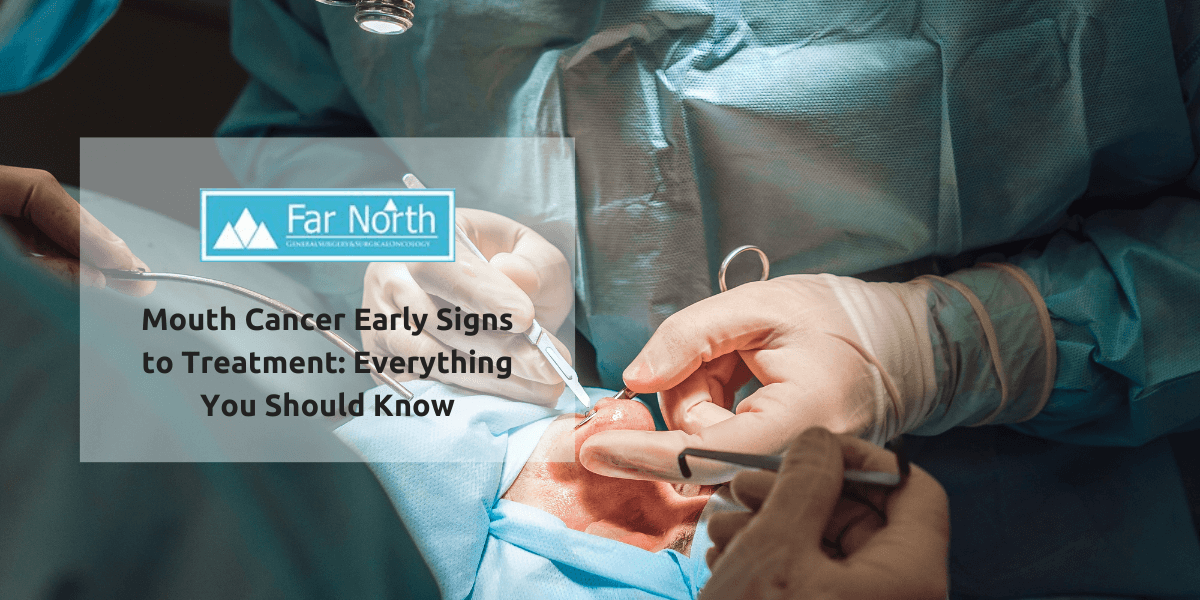 Mouth Cancer Early Signs to Treatment: Everything You Should Know