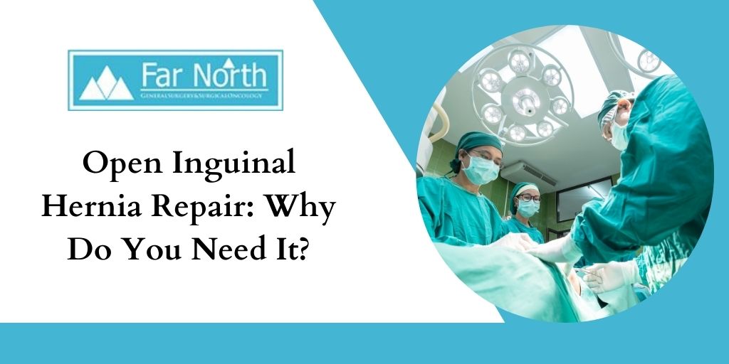 Open Inguinal Hernia Repair: Why Do You Need It?