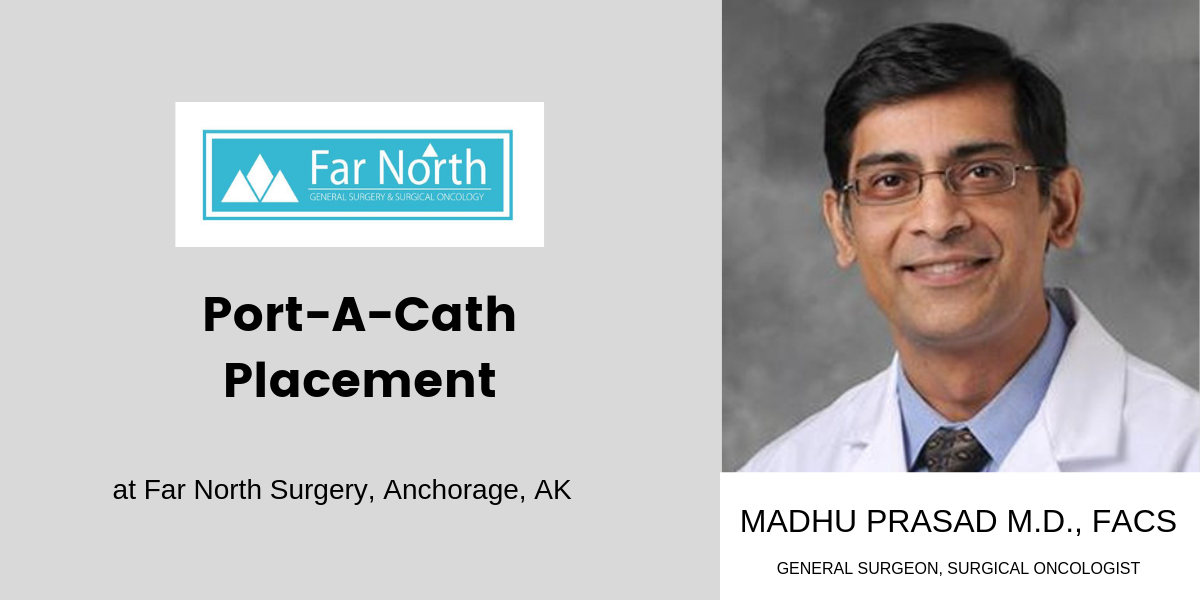 Port-A-Cath Placement in Anchorage, AK