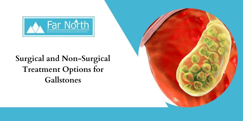 Surgical and Non-Surgical Treatment Options for Gallstones