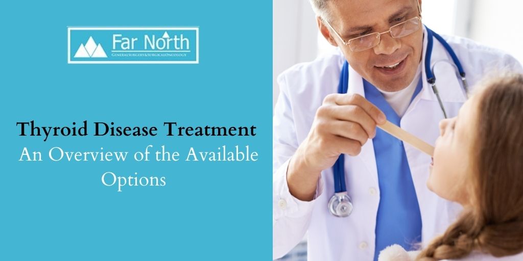 Thyroid Disease Treatment- An Overview of the Available Options 