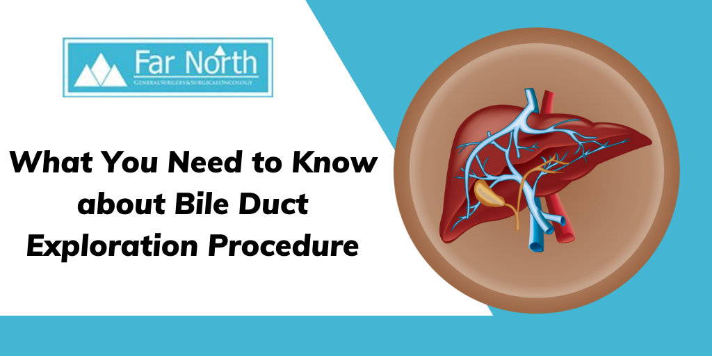 What You Need to Know about Bile Duct Exploration Procedure