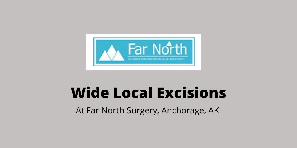 Wide Local Excisions in Anchorage, AK