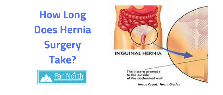 How Long Does Hernia Surgery Take?