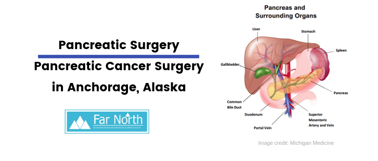 Pancreatic Surgery Types | Pancreatic Cancer Surgery - Anchorage, Alaska