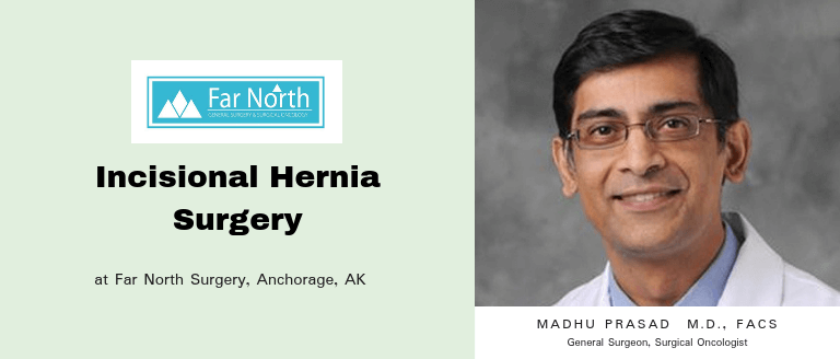 Incisional Hernia Surgery in Anchorage, AK