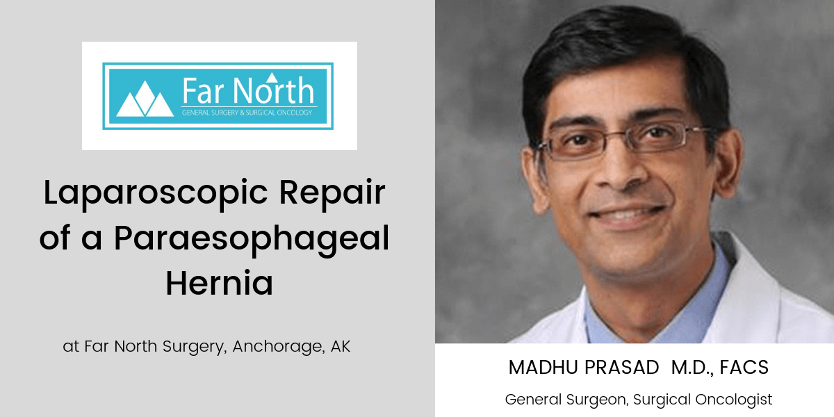 Laparoscopic Repair of a Paraesophageal Hernia in Anchorage, Alaska